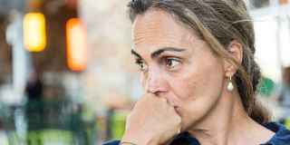 Systemic Lupus Erythematosus Sle Dermatology Advisor
