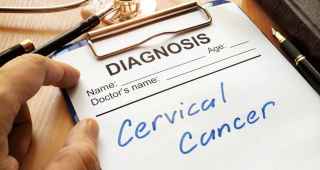 Phd thesis on cervical cancer
