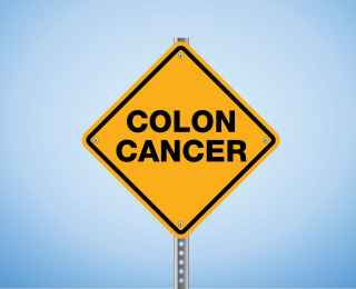 Colon Cancer, Gut Bacteria, and Diet