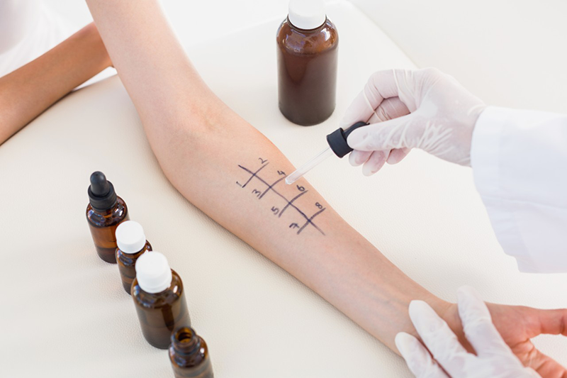 29 Jan 2015 --- Doctor doing skin prick test at her patient --- Image by © Wavebreakmedia LTD/Wavebreak Media Ltd./Corbis