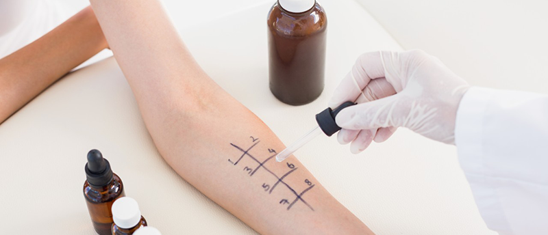 42-72742439 29 Jan 2015 --- Doctor doing skin prick test at her patient --- Image by © Wavebreakmedia LTD/Wavebreak Media Ltd./Corbis