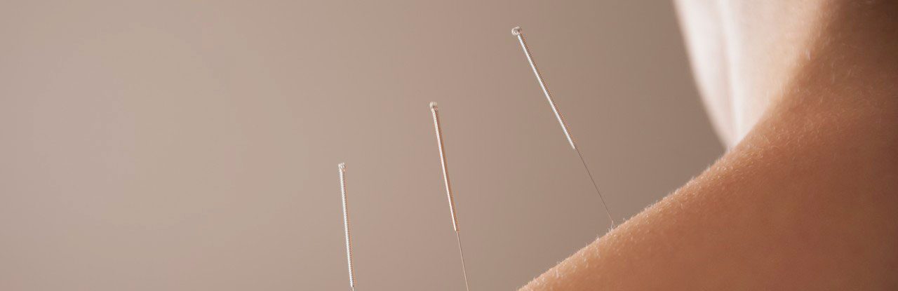 0042-11-30T00:00:00.000Z Chiropractor adjusting woman's spine --- Image by © Gabriela Medina/Blend Images/Corbis