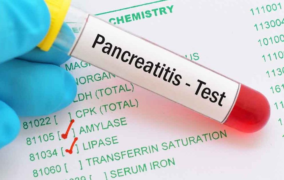 Pancreatitis Symptoms