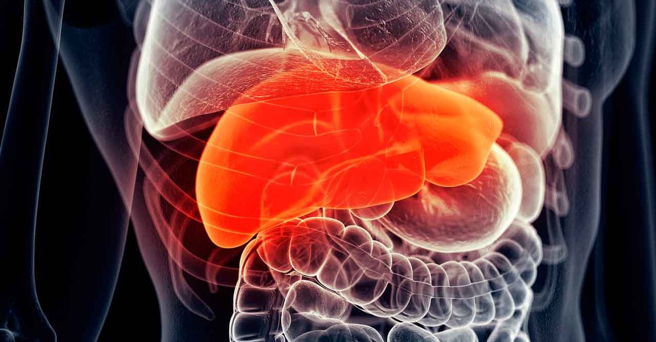 Signs of Fatty Liver