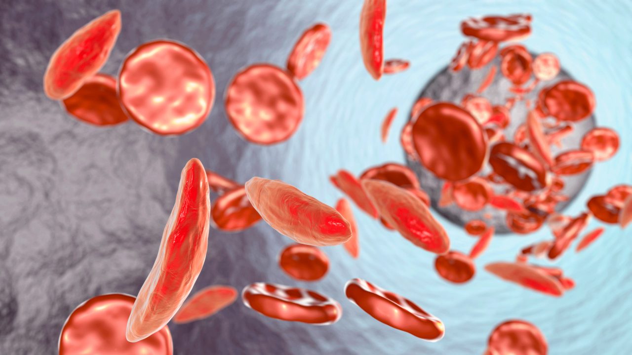 What Is Anemia? What Is Anemia?