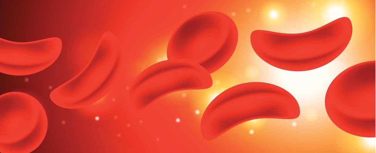 What Is Sickle Cell Anemia?