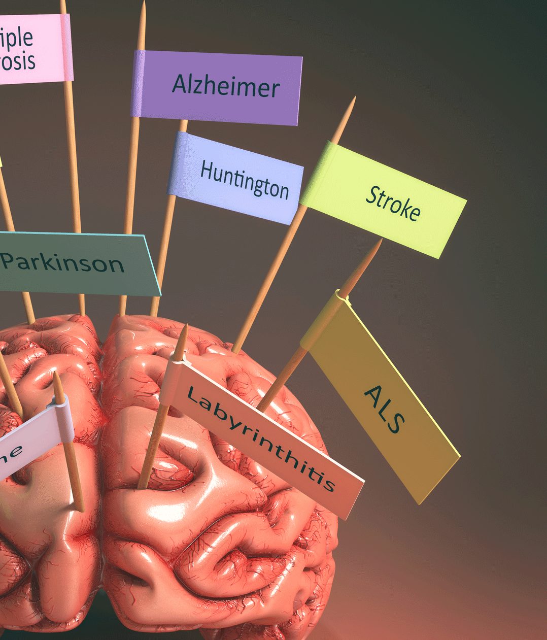 Amyotrophic Lateral Sclerosis Symptoms — Page 2