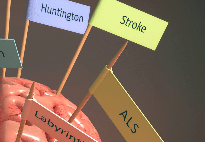 What Causes ALS? What Causes ALS?