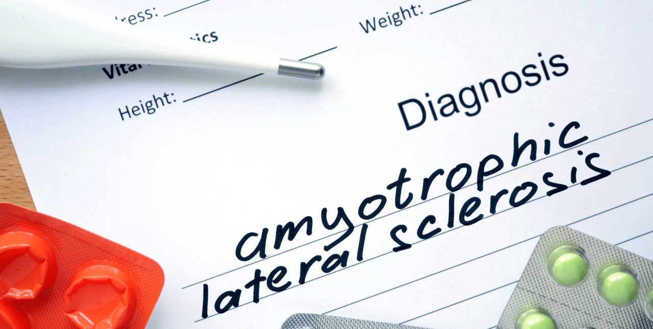 Who Gets an Amyotrophic Lateral Sclerosis Diagnosis? — Page 2