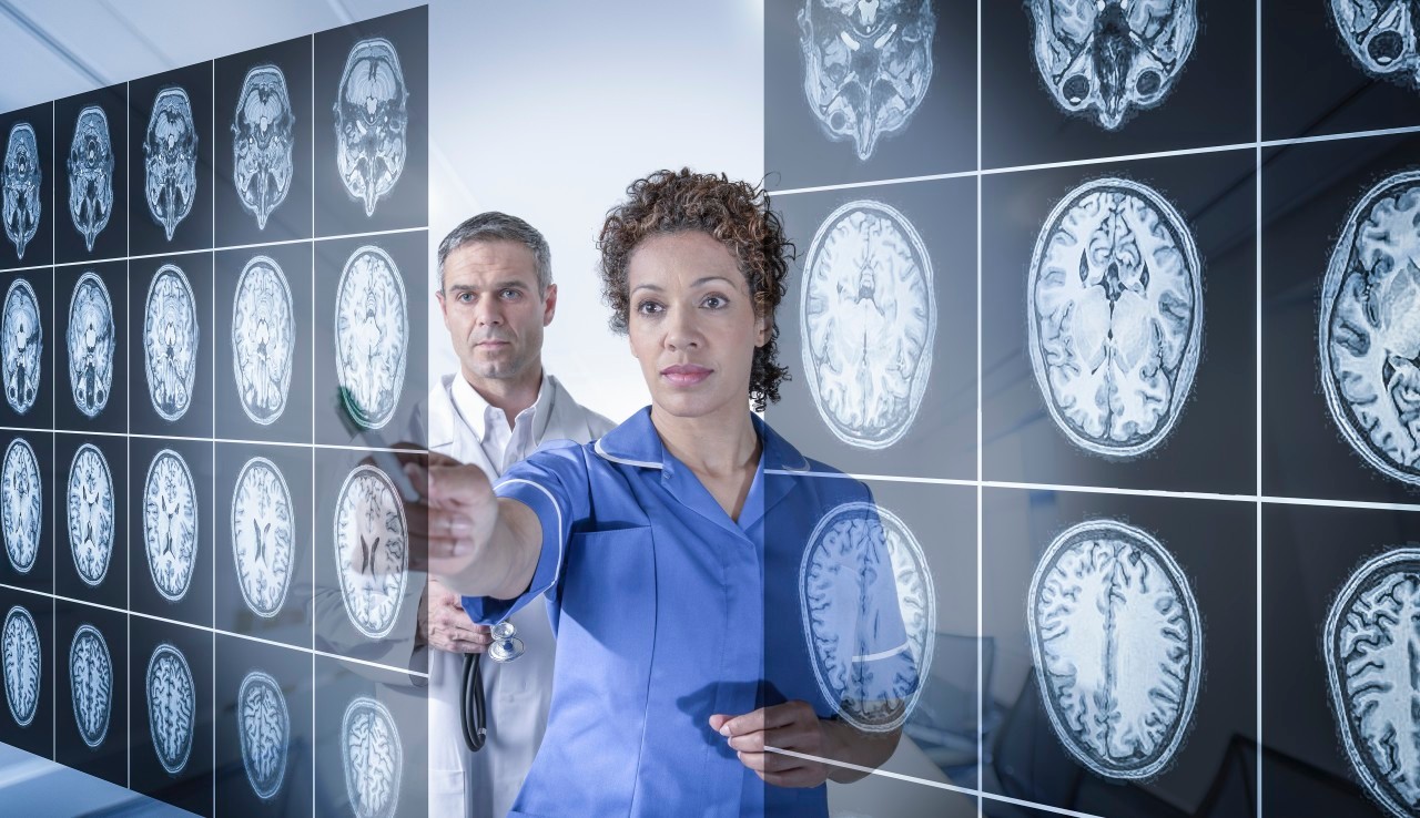 Doctor and nurse working with MRI brain scans seen through interactive display --- Image by © Monty Rakusen/Corbis