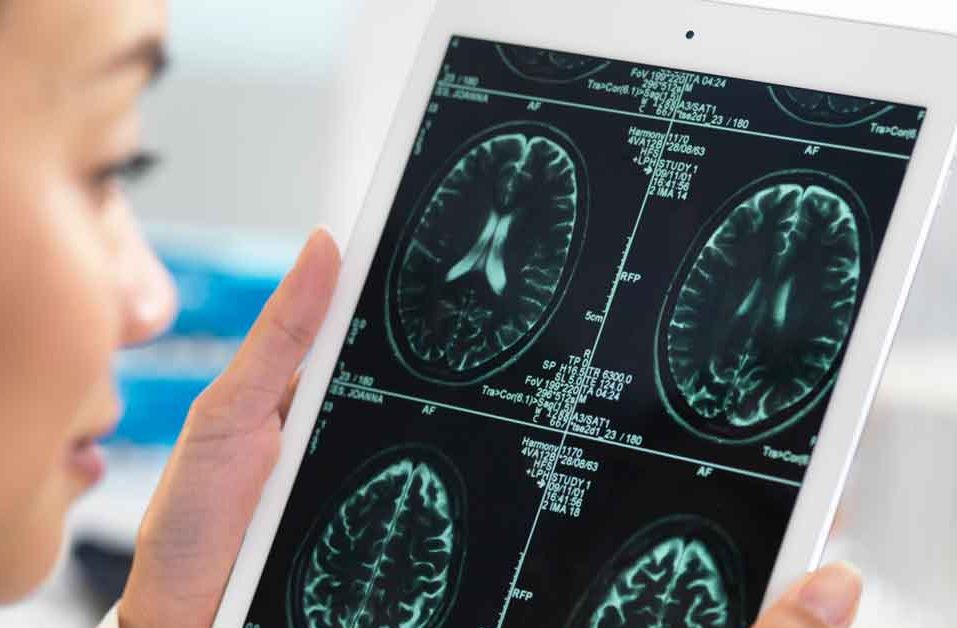 What is type 3 diabetes? Learn about the different kinds of diabetes, why you should know the early signs of Alzheimer’s, and how to manage your symptoms. What is type 3 diabetes?