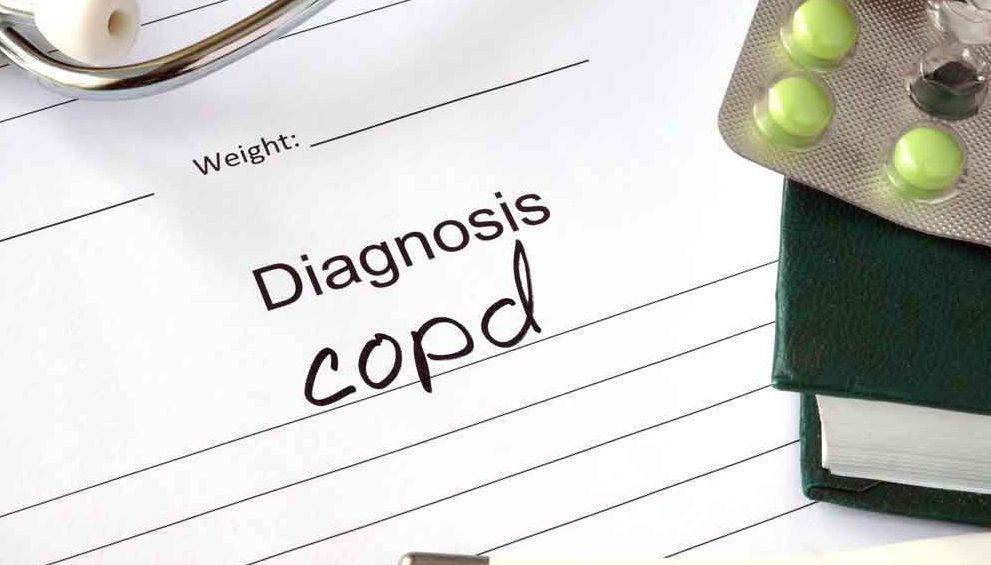 The Stages of Chronic Obstructive Pulmonary Disease