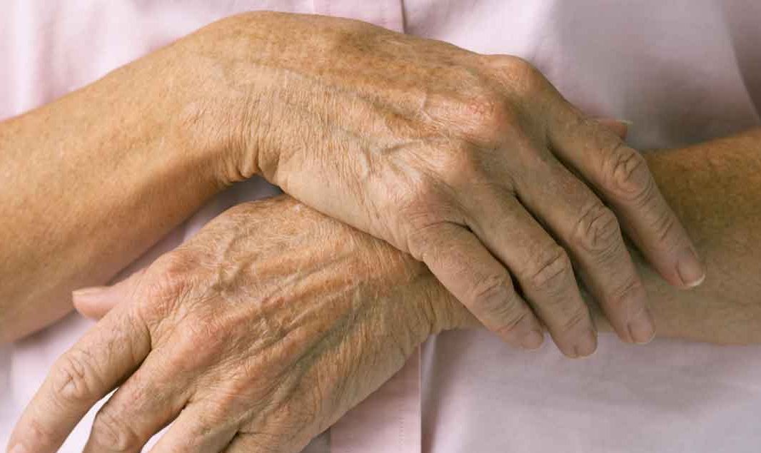 Living with Essential Tremor
