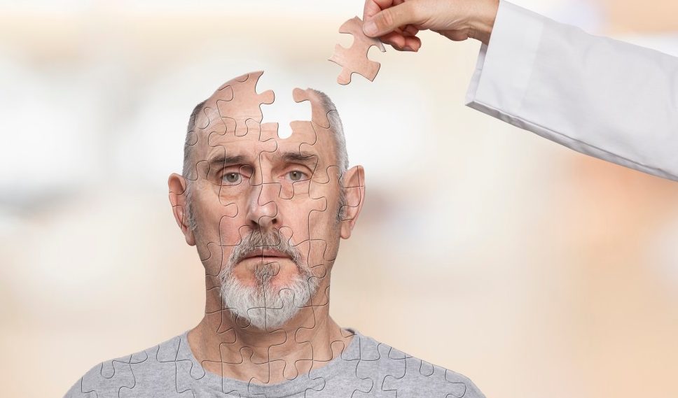 16 Jun 2014 --- Doctor putting human puzzle together --- Image by © John Lund/Blend Images/Corbis