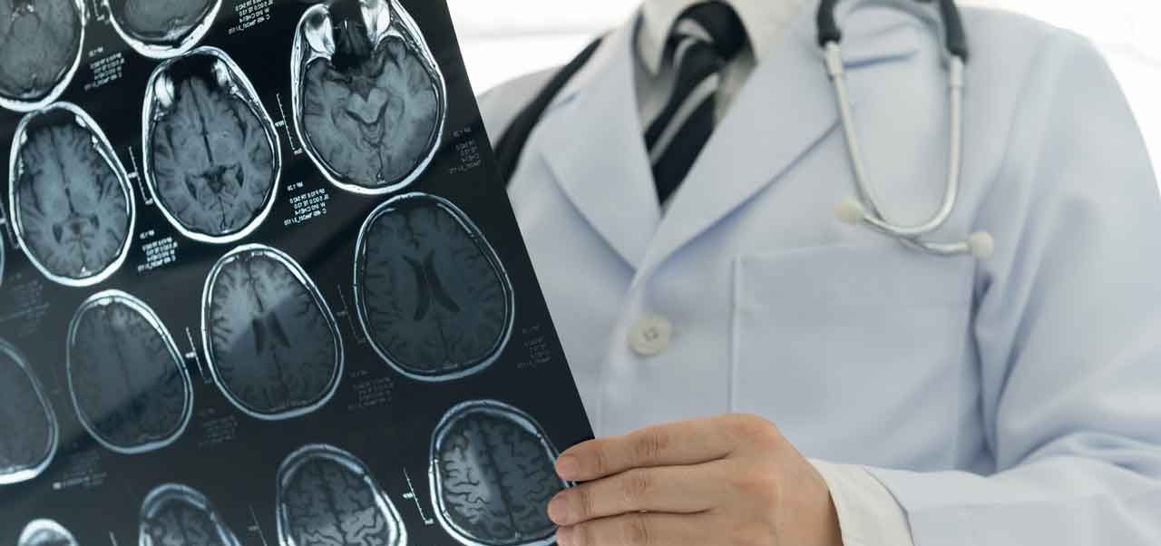 Stroke Symptoms in Women Stroke Symptoms in Women