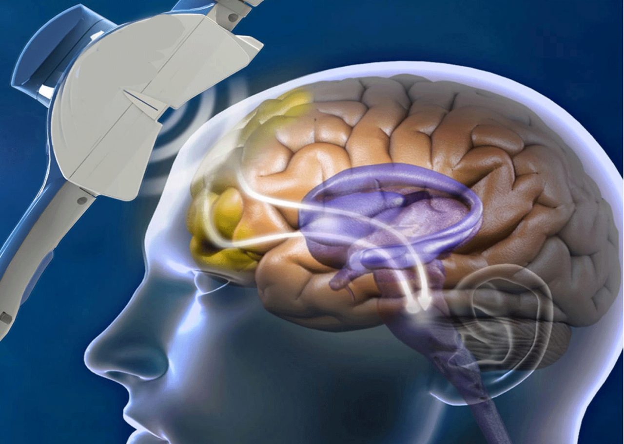 Transcranial Magnetic Stimulation for Autism: Fact or Fiction?