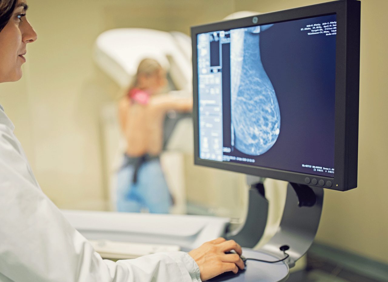 Breast Cancer Diagnosis