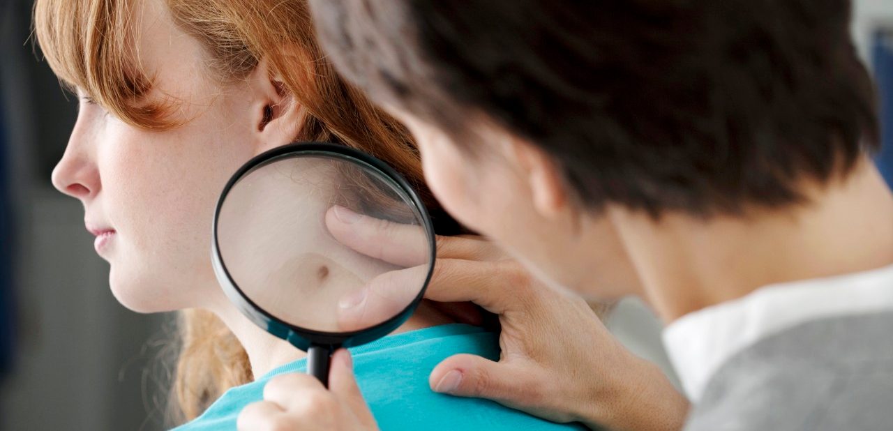 20 Nov 2012 --- Dermatology consultation woman --- Image by © B. Boissonnet/BSIP/Corbis
