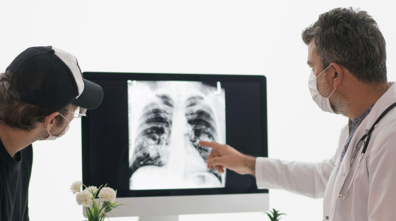 How Does My Doctor Know I Have Lung Cancer?