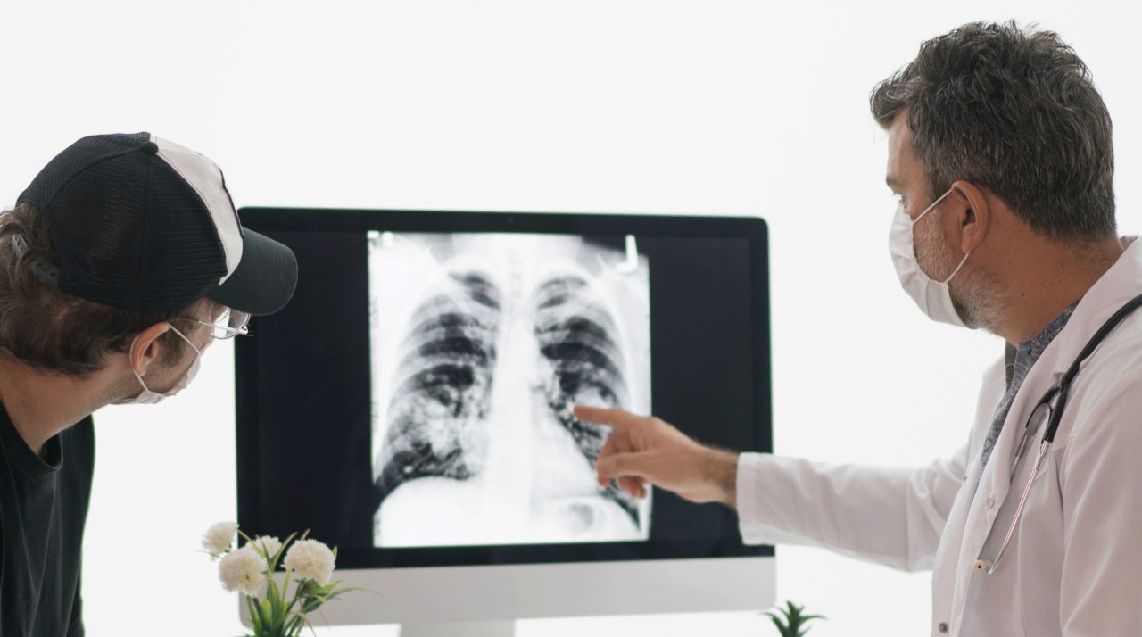 How Does My Doctor Know I Have Lung Cancer? How Does My Doctor Know I Have Lung Cancer?