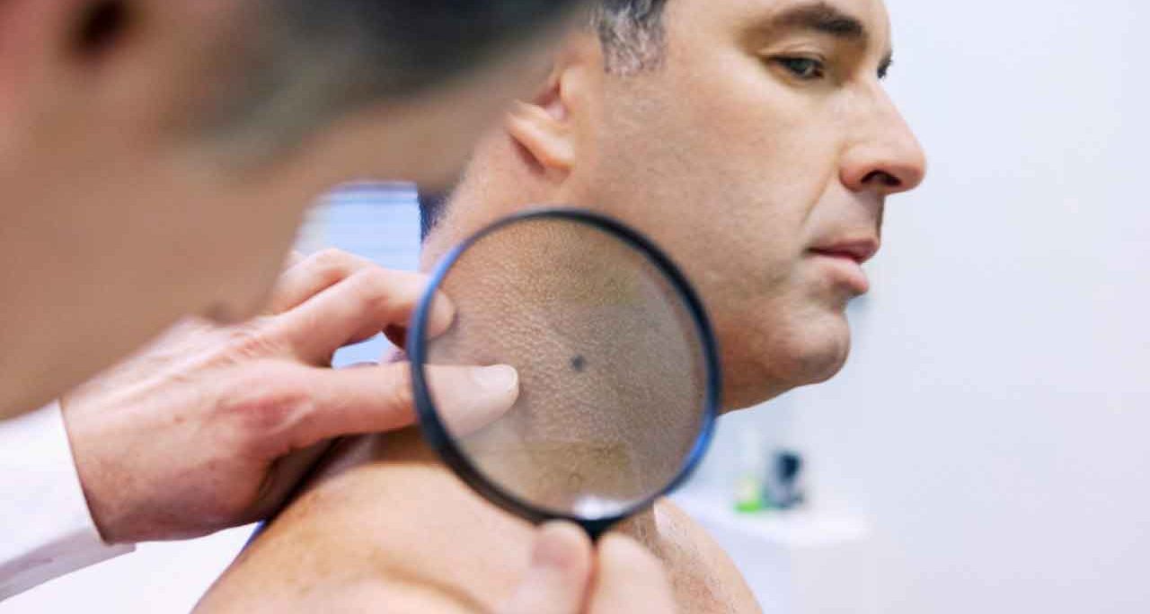 Veterans Have a Higher Skin Cancer Risk