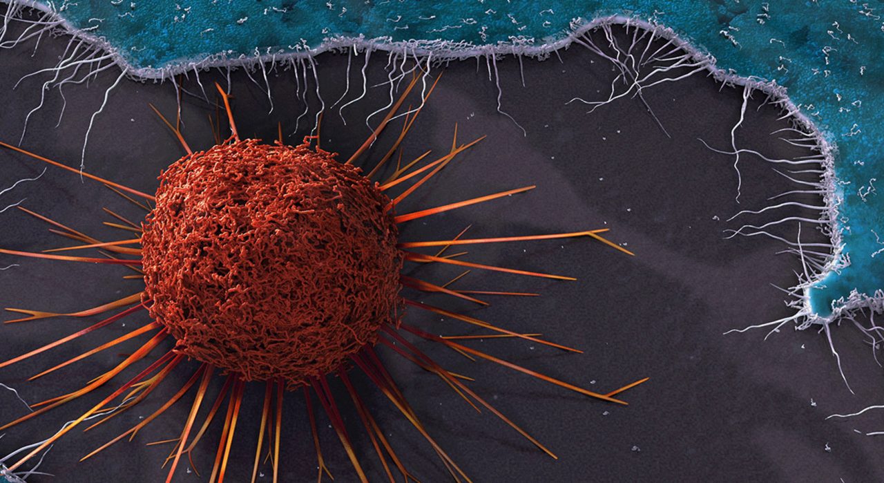 Treatment for Cervical Cancer Treatment for Cervical Cancer