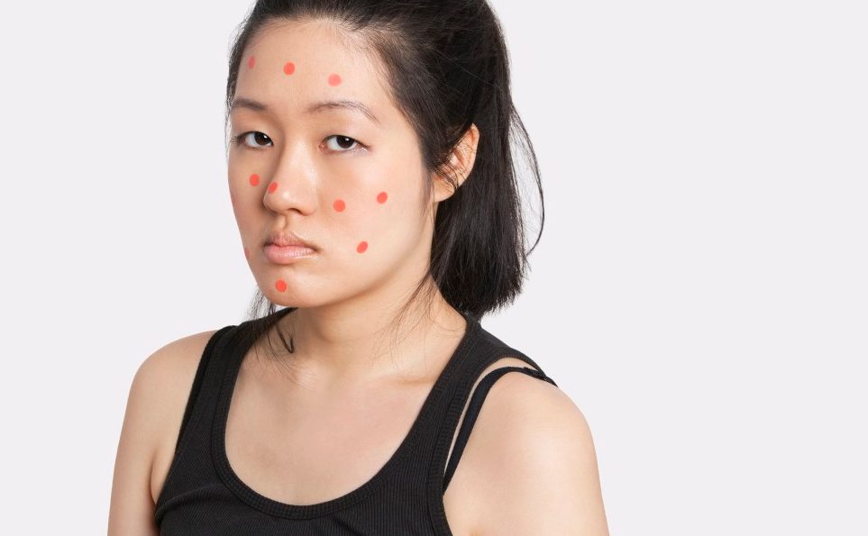 America Has Eradicated Rubella America Has Eradicated Rubella
