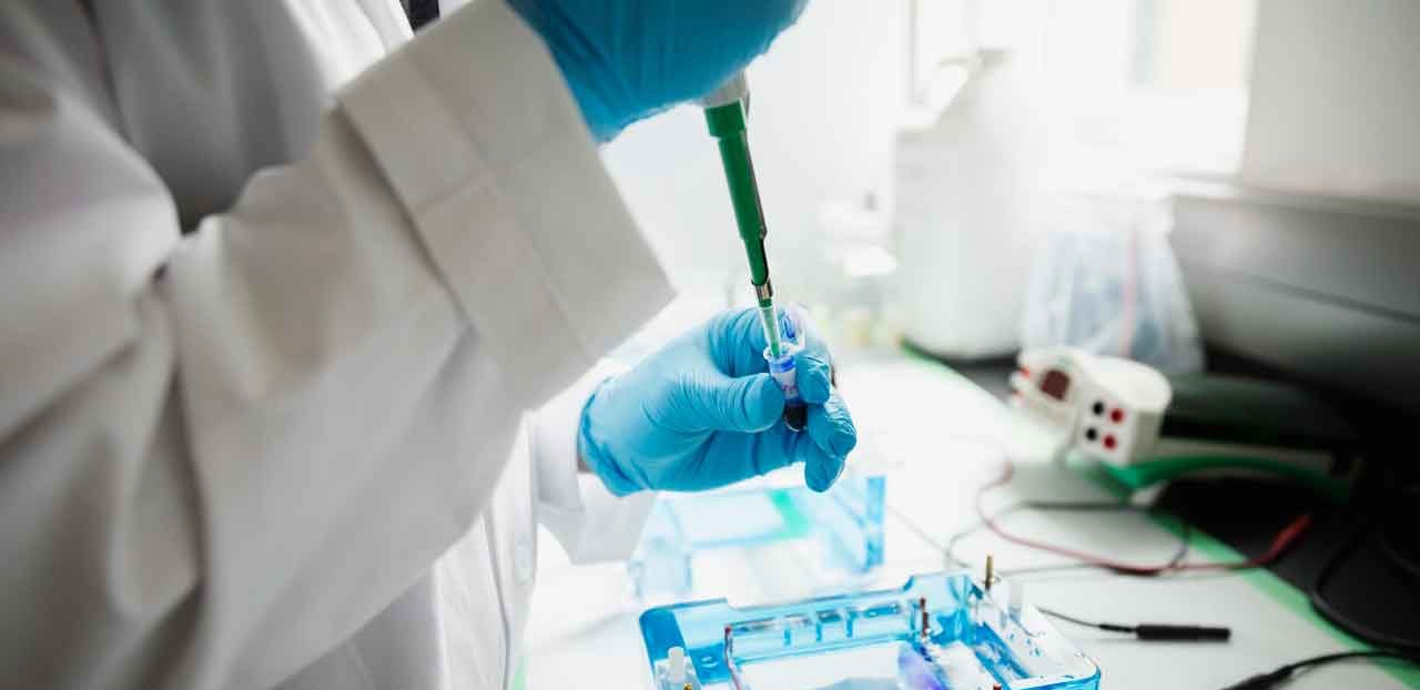 Stool DNA Test for Colon Cancer