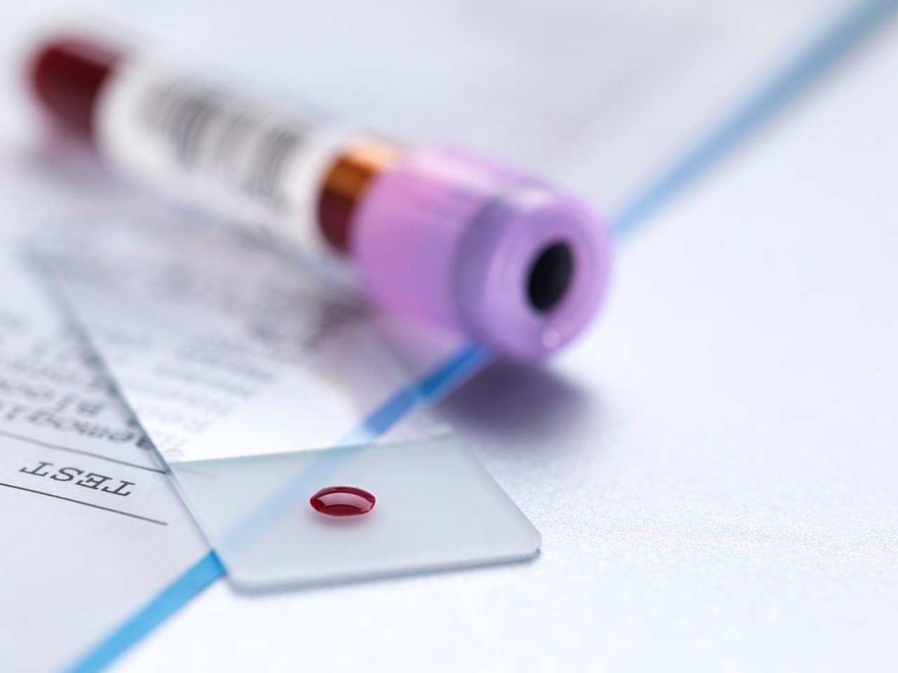 Blood sample on microscope slide with vial and results of the blood test. --- Image by © Andrew Brookes/Corbis