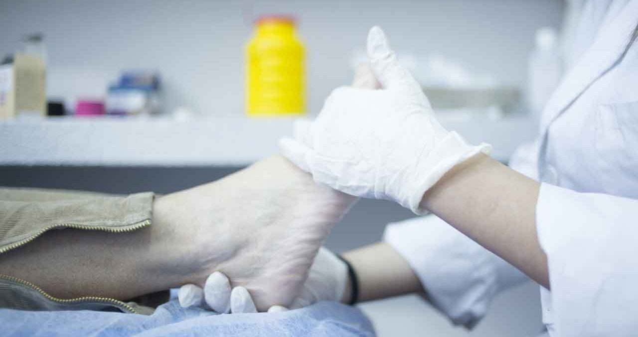 What Is Hammer Toe?
