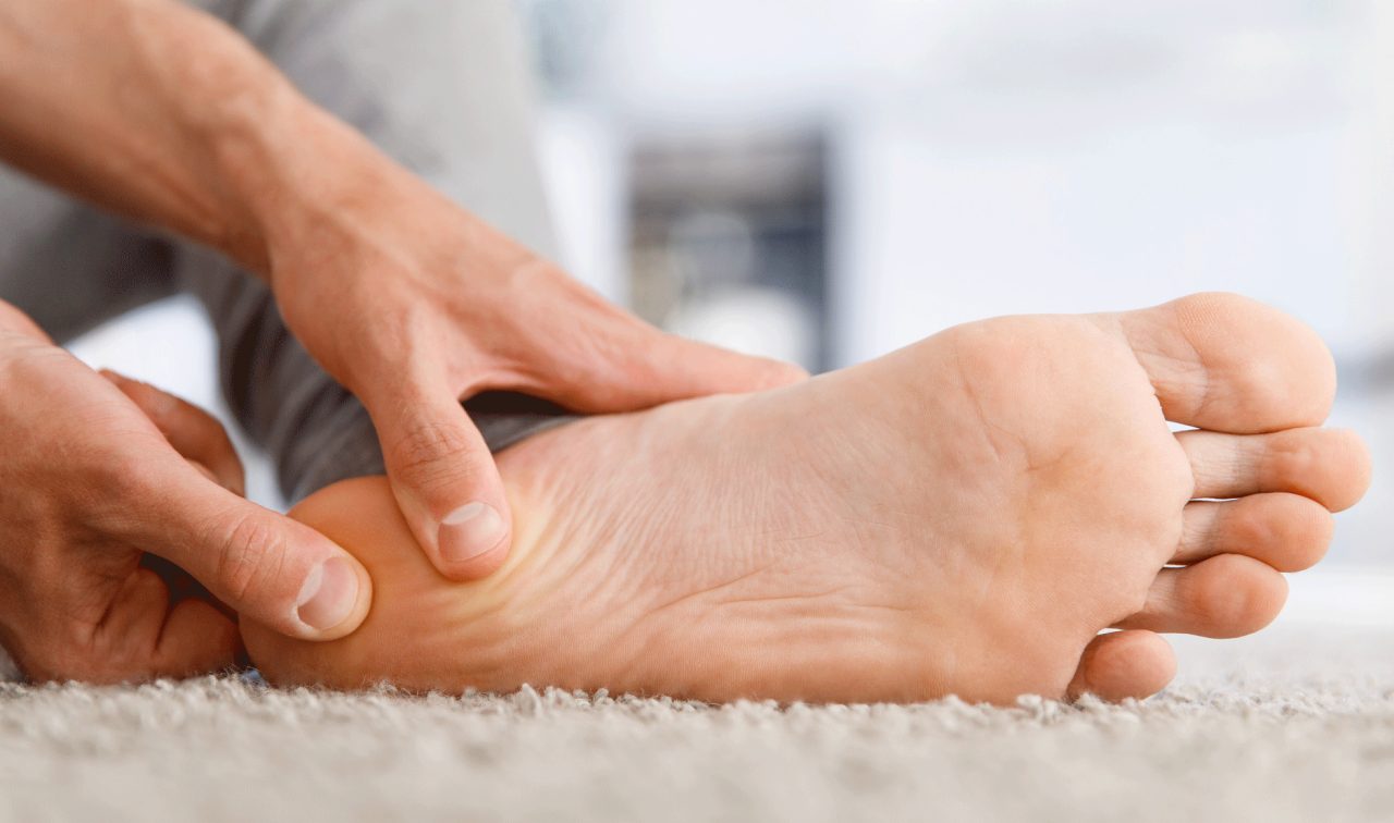 What Is Plantar Fasciitis?