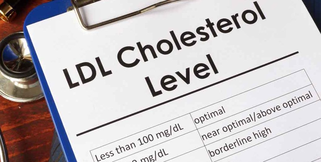 Symptoms of High Cholesterol