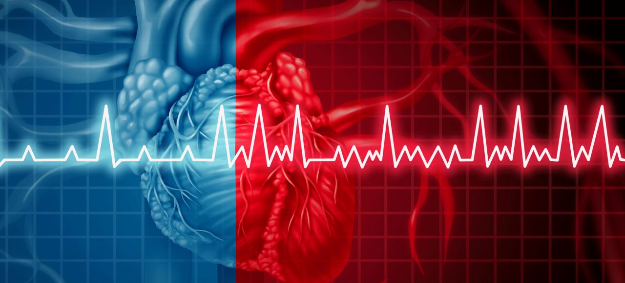 What Is Atrial Fibrillation?