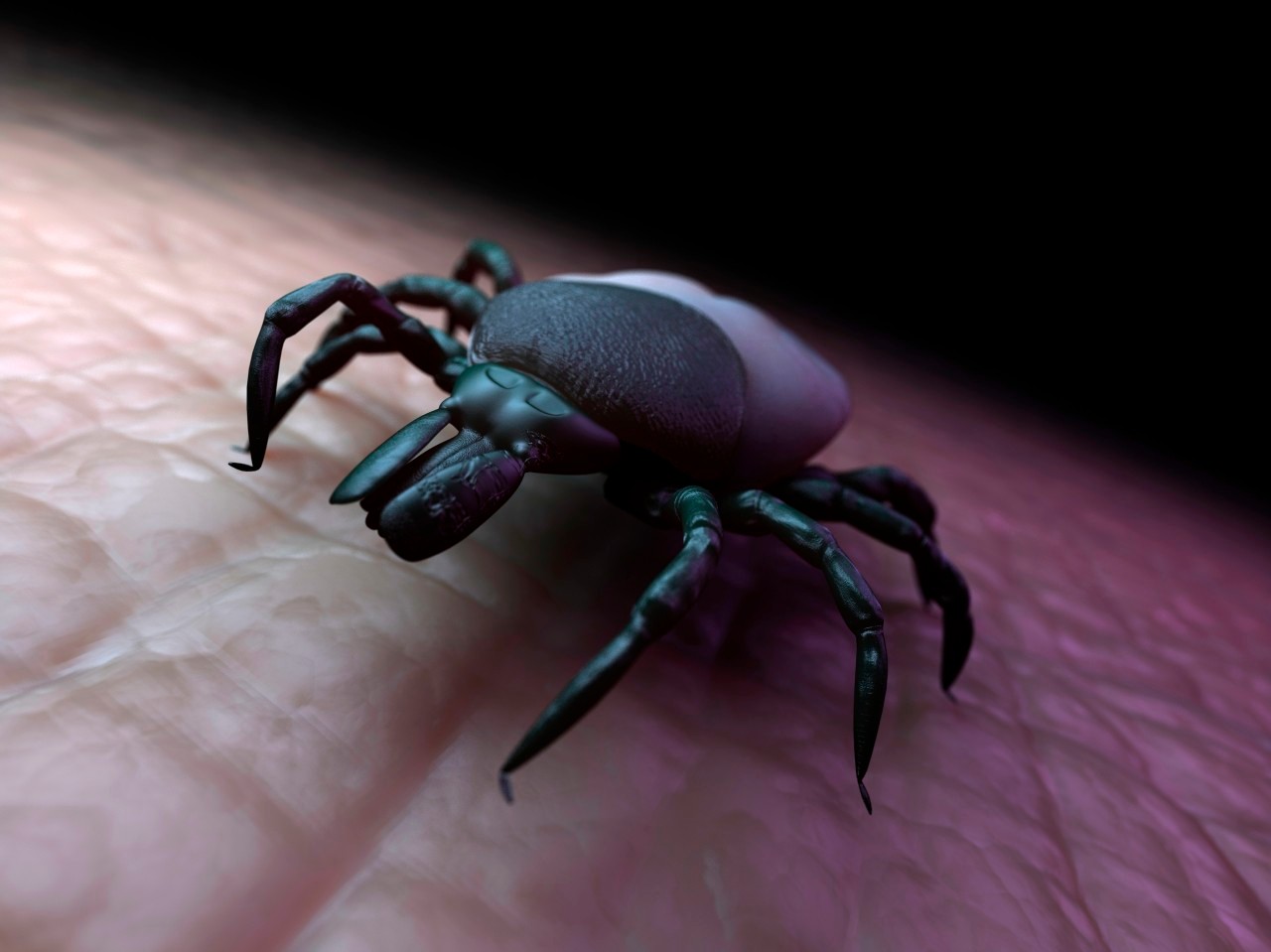 28 Feb 2012 --- Tick (superfamily Ixodoidea) on human skin, computer artwork. --- Image by © Sciepro/Science Photo Library/Corbis