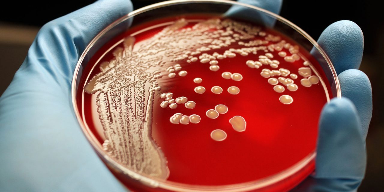 How Do You Get MRSA?