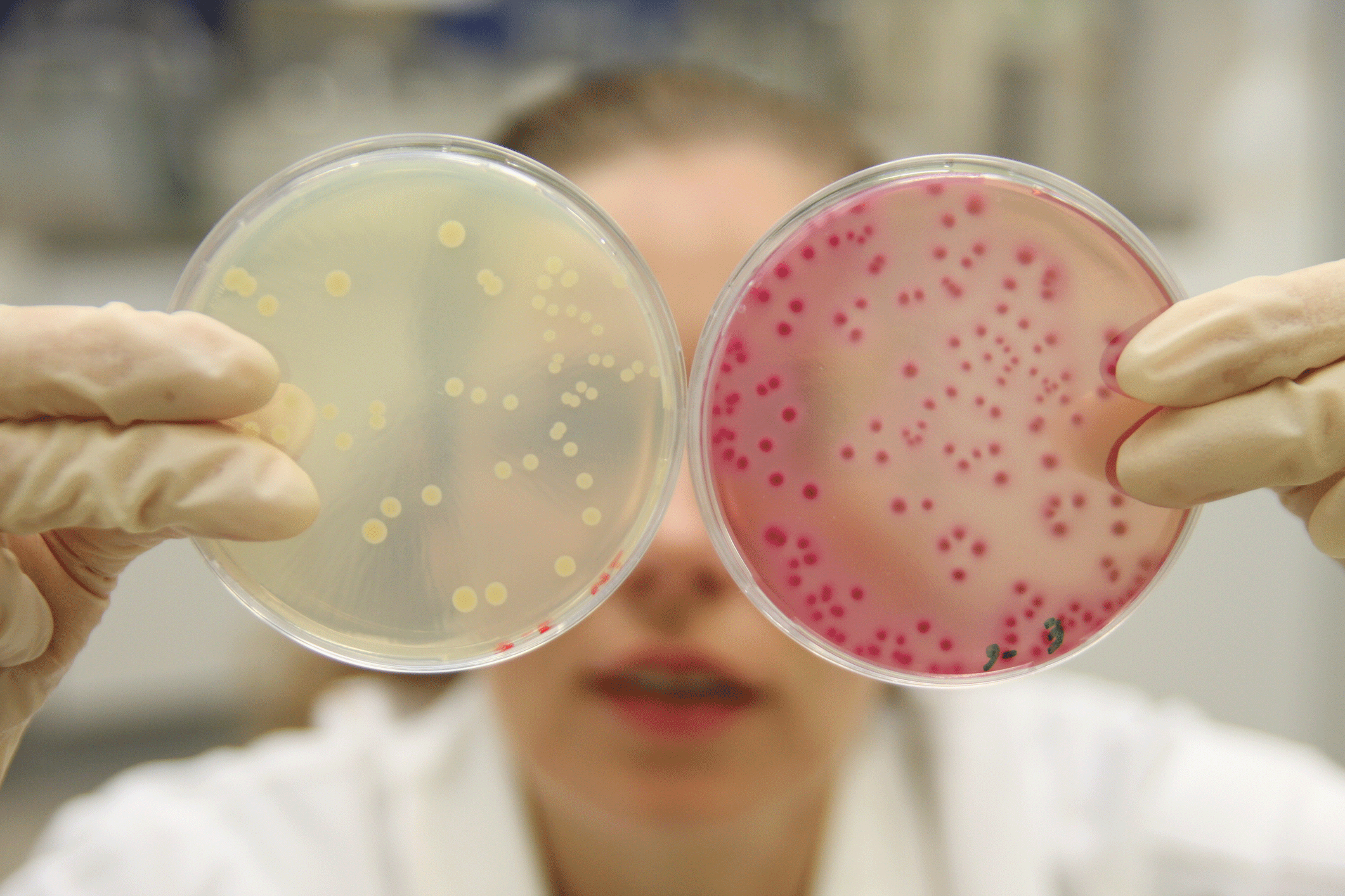 What Are Antibiotic-Resistant Bacteria?