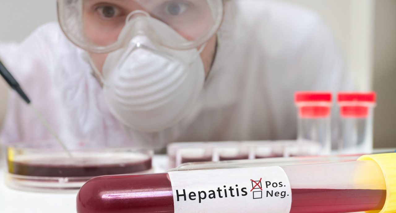 What Is Hepatitis A?