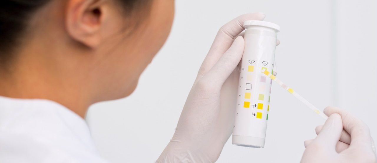 0042-11-30T00:00:00.000Z Female scientist testing urine sample --- Image by © Judith Haeusler/Corbis