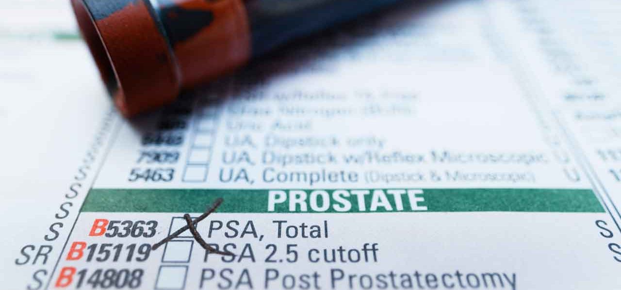 Benign Prostatic Hyperplasia Symptoms 