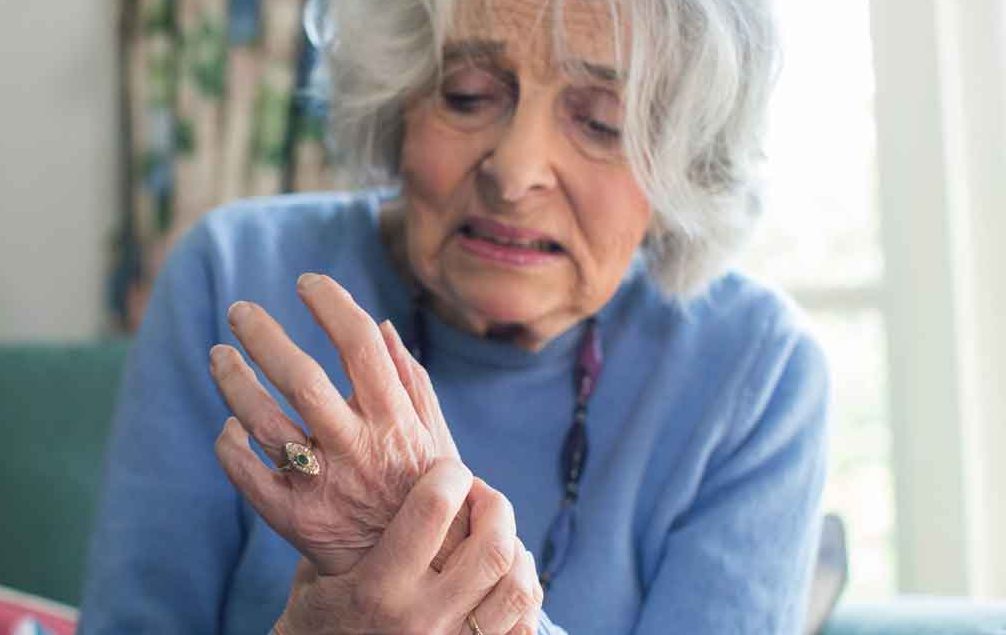 Rheumatoid Arthritis Symptoms