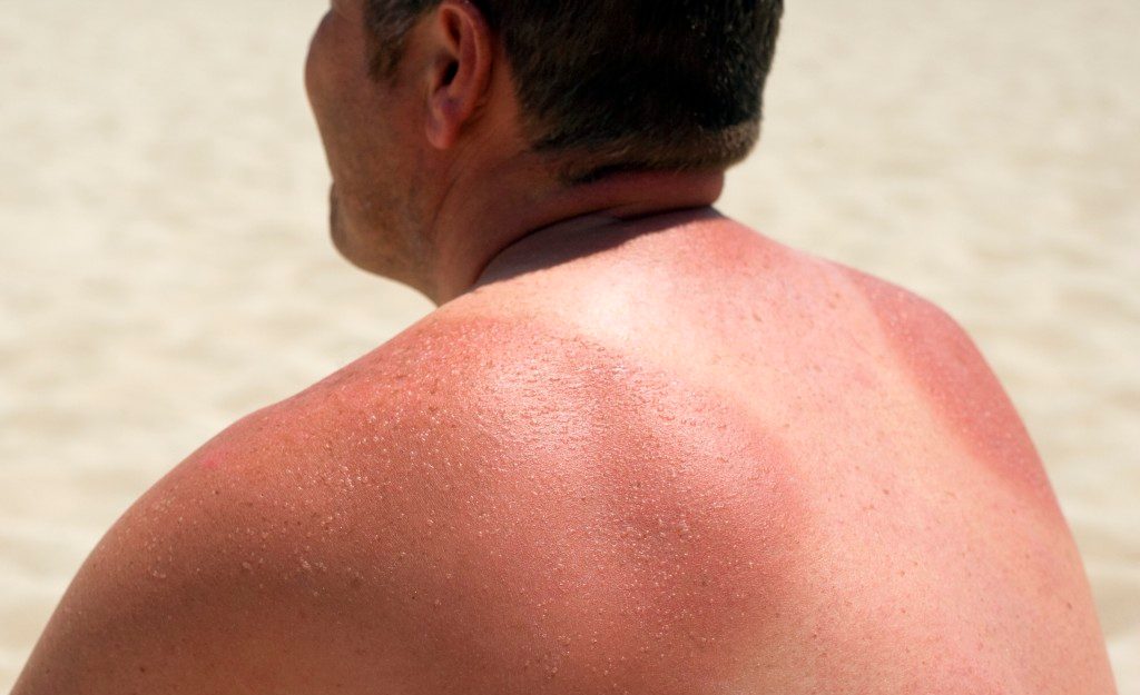 Does Your Sunscreen Do What It Advertises?