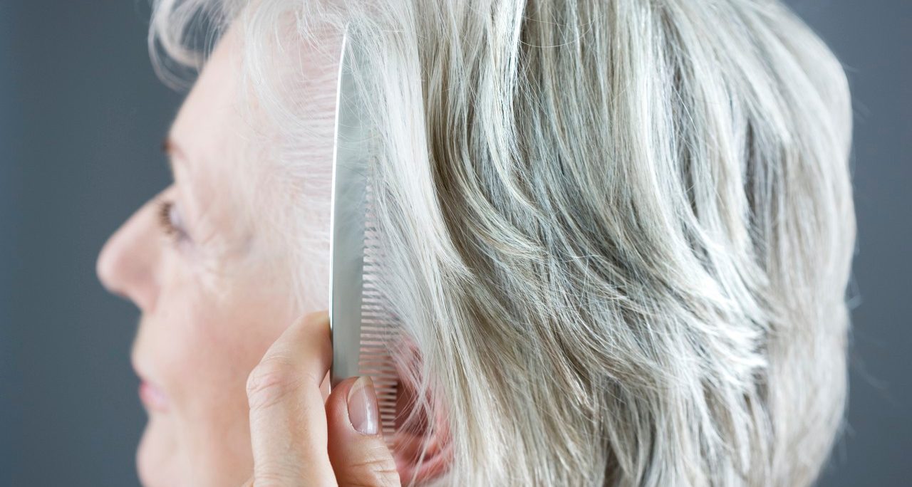 Can Women Control Hair Loss?