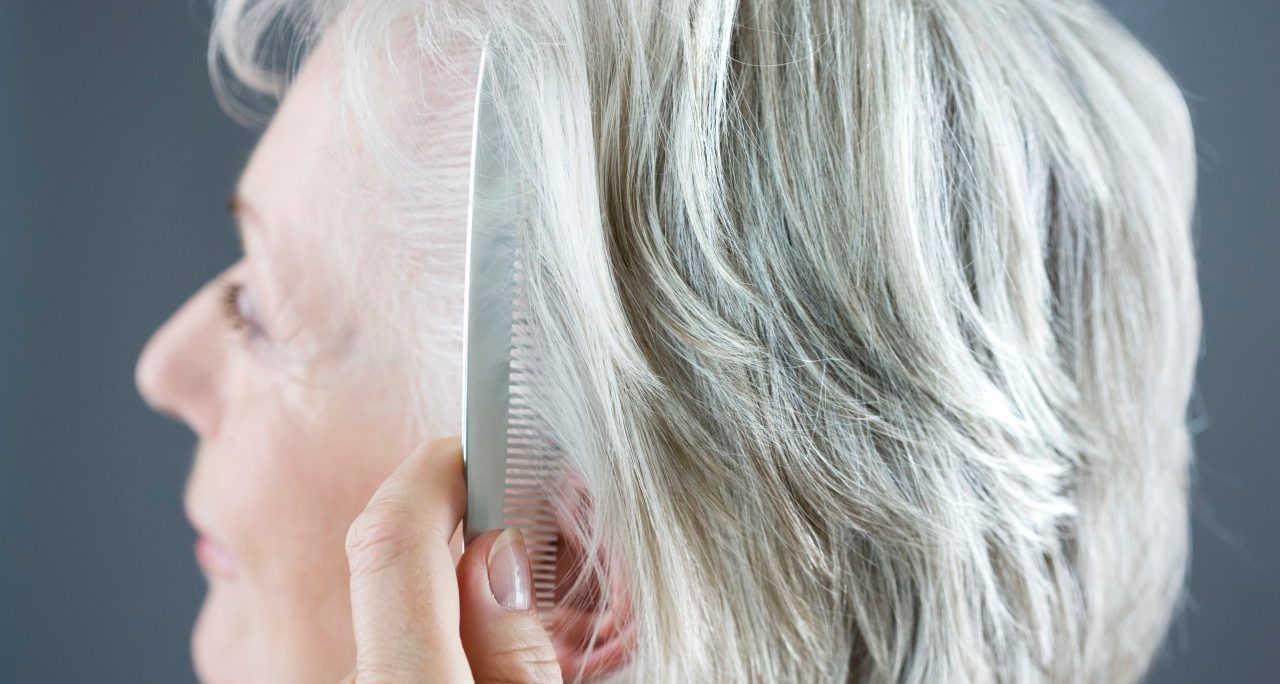 Can Women Control Hair Loss? Can Women Control Hair Loss?