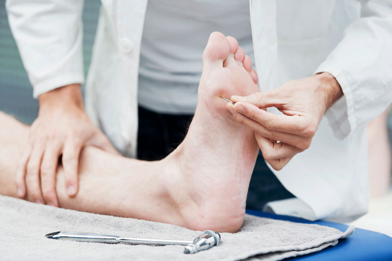 What Is Diabetic Neuropathy?