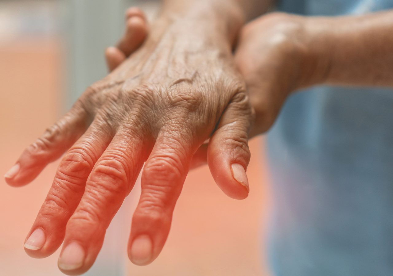 What Is Peripheral Neuropathy?