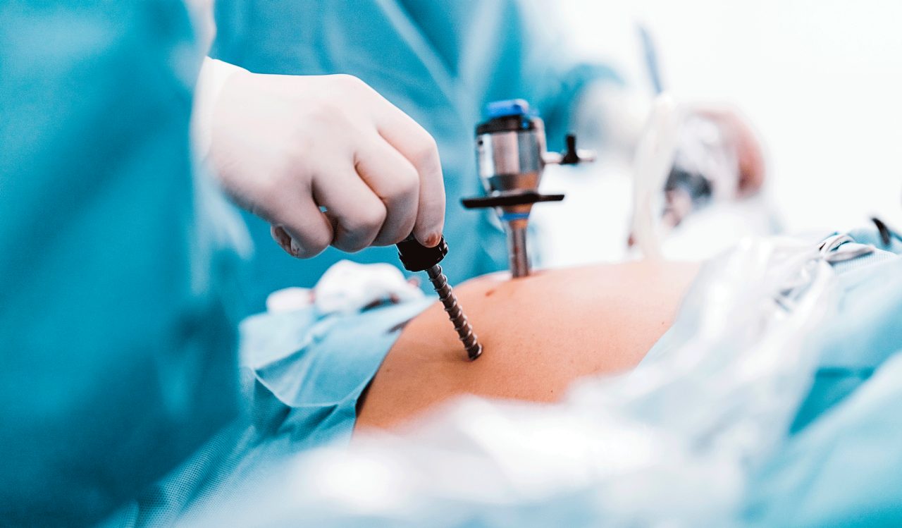 Bariatric Surgery Can Cut Your Risk of Cancer Bariatric Surgery Can Cut Your Risk of Cancer