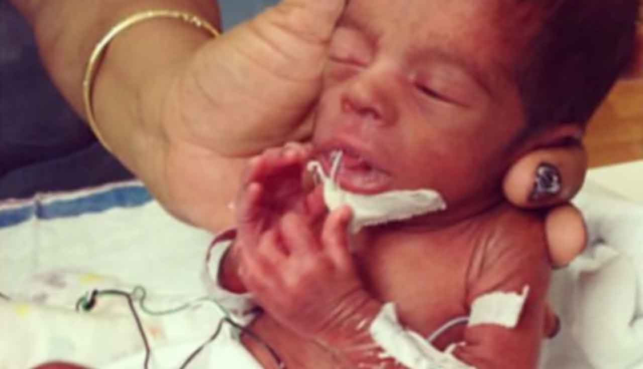 The Heartbreak and Joy of Premature Babies The Heartbreak and Joy of Premature Babies