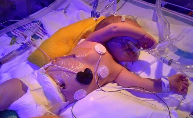 The Heartbreak and Joy of Premature Babies