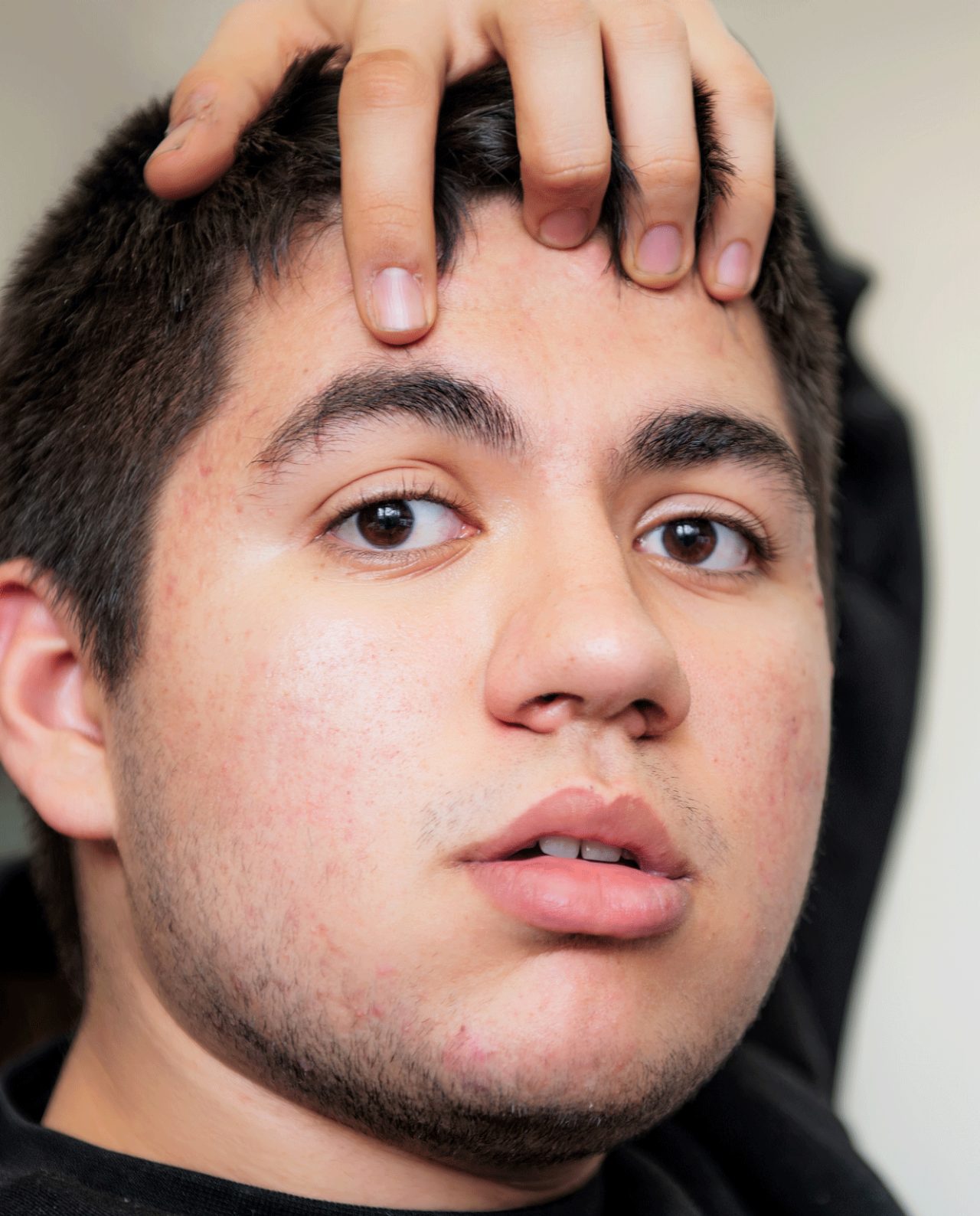 What Is Tourette Syndrome? What Is Tourette Syndrome?