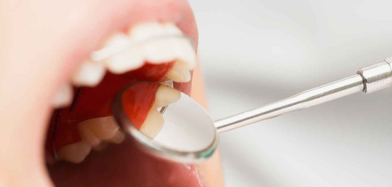 How to Keep Your Gums Healthy